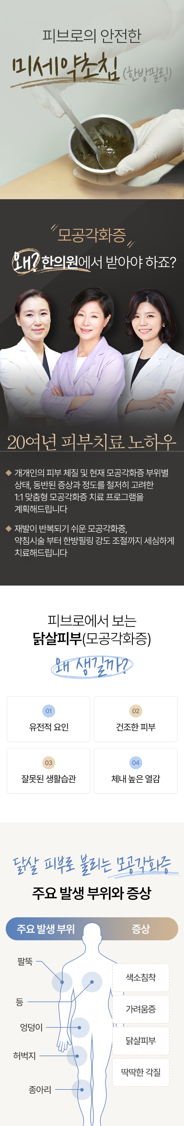 모공각화증 치료